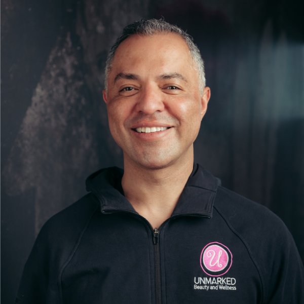 Al Heredia, laser technician at Unmarked Beauty and Wellness
